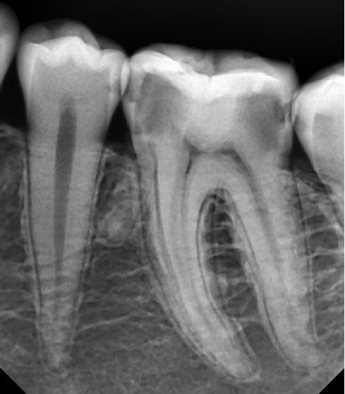 Рентген зубов: виды снимков, вред, противопоказания